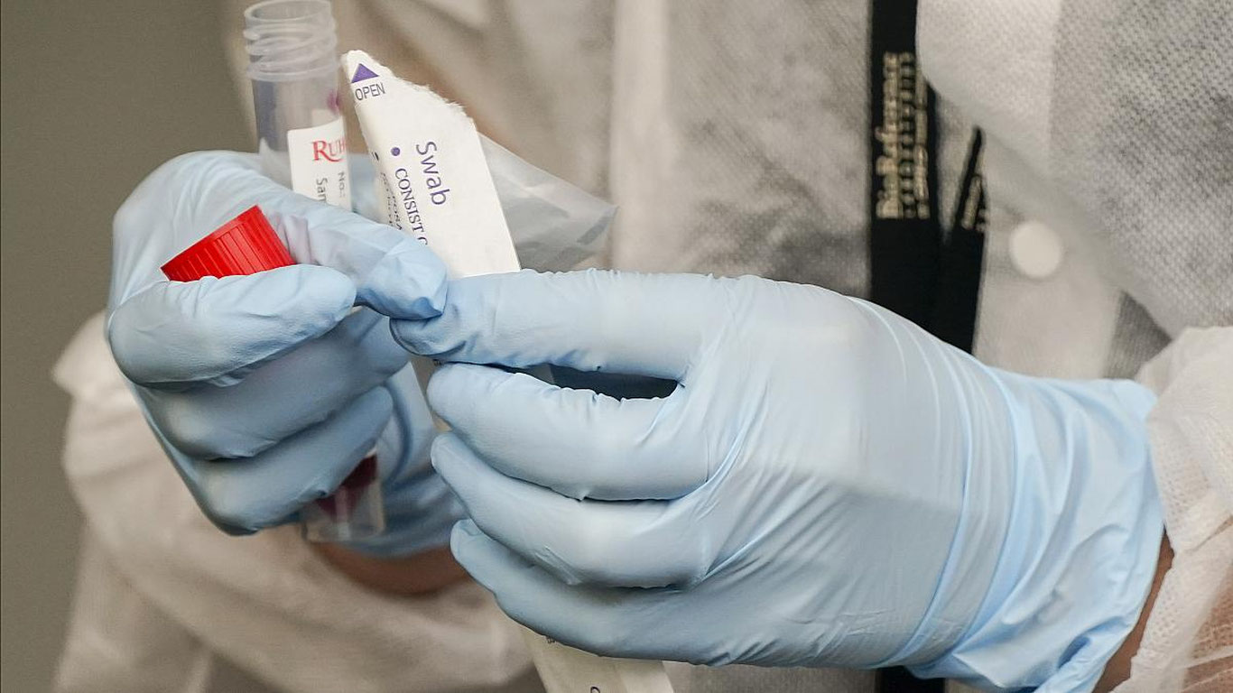 Kecha yurtimizda koronavirus sabab 3 nafar bemor vafot etdi