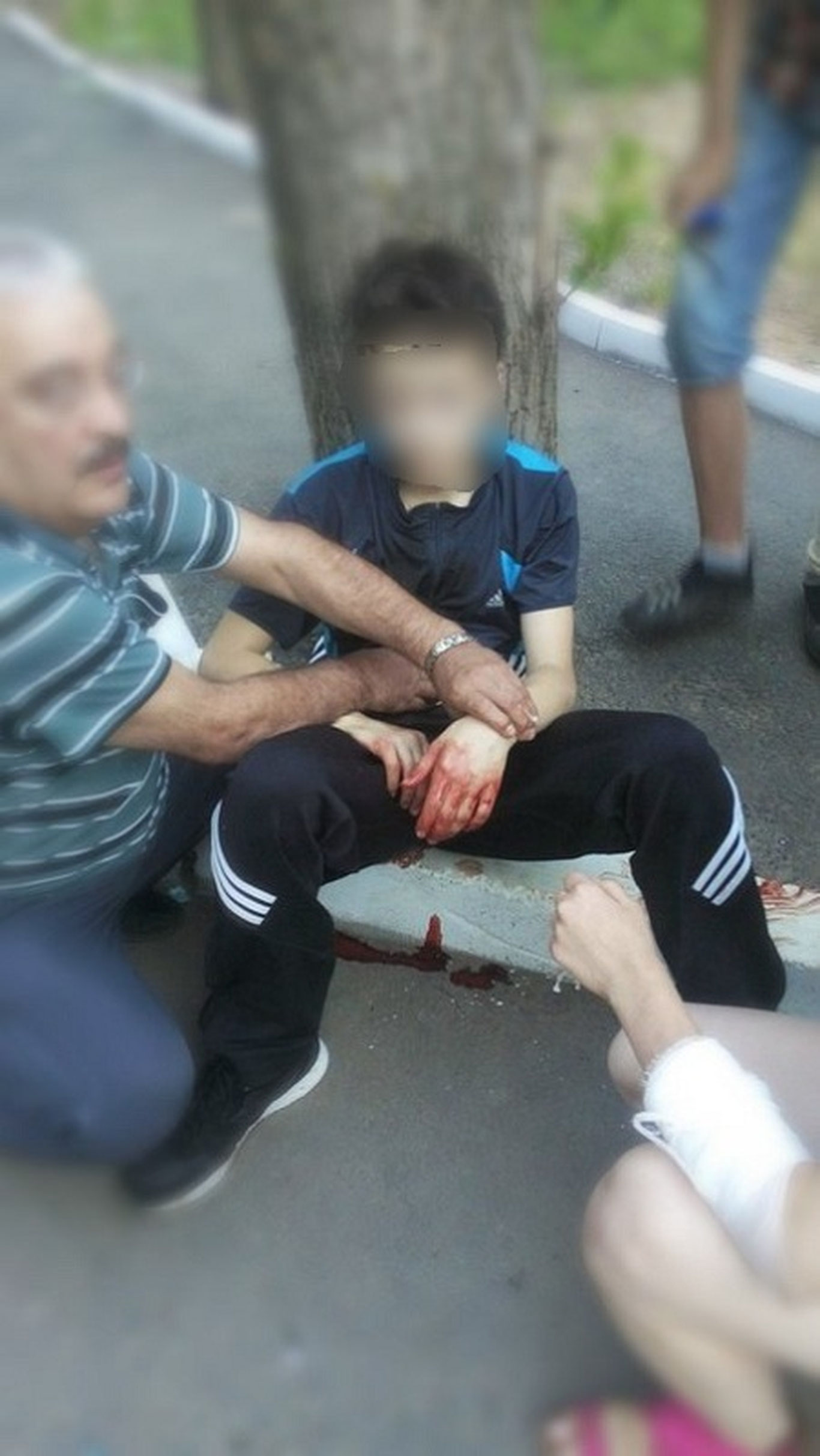 Россияда 12 ёшли ўсмир отасининг гапи билан шифокорни пичоқлади