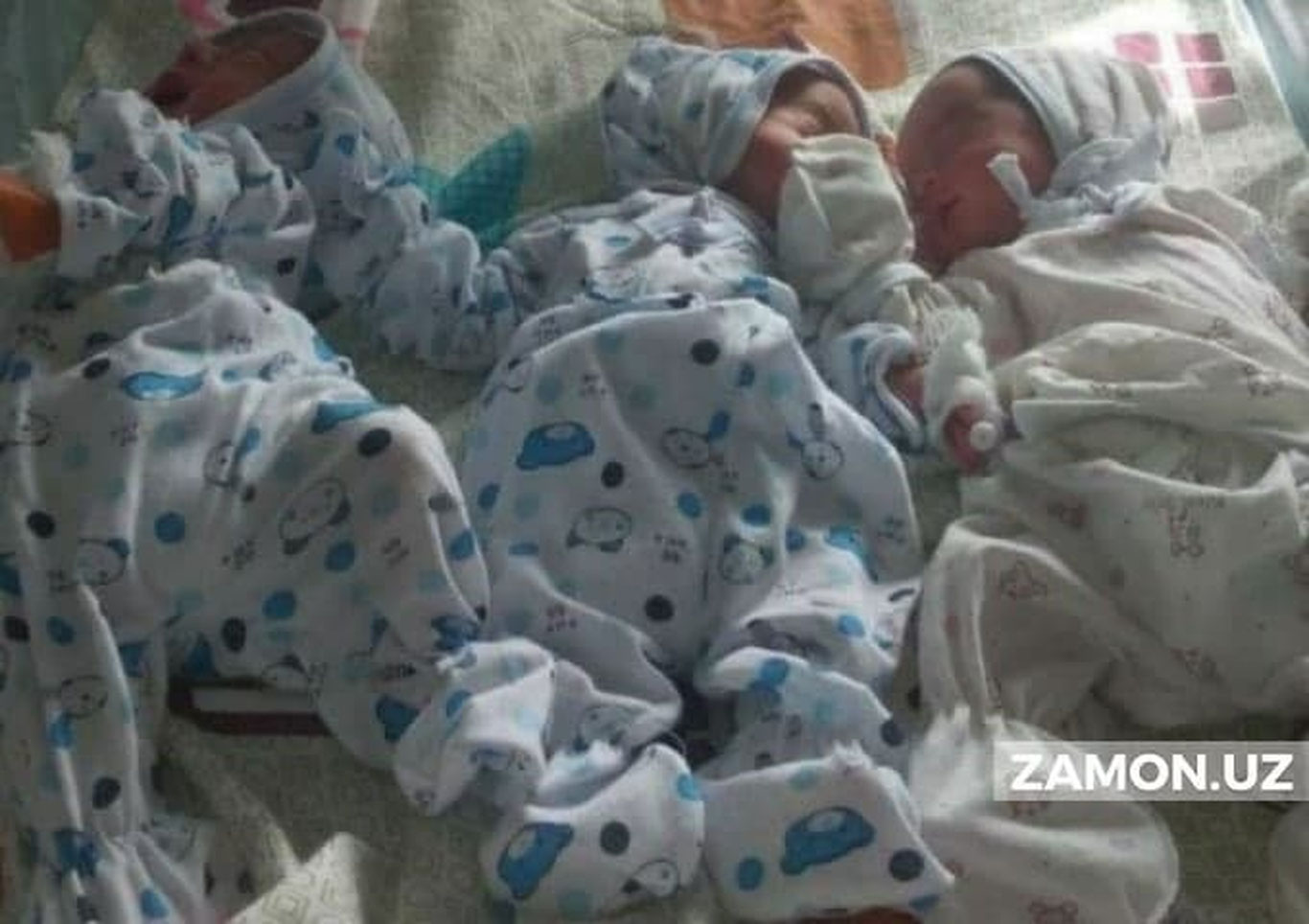 Qashqadaryoda tug‘ilgan 3 egizakka Ziroat, Saida va Shahnoza ismlari qo‘yildi