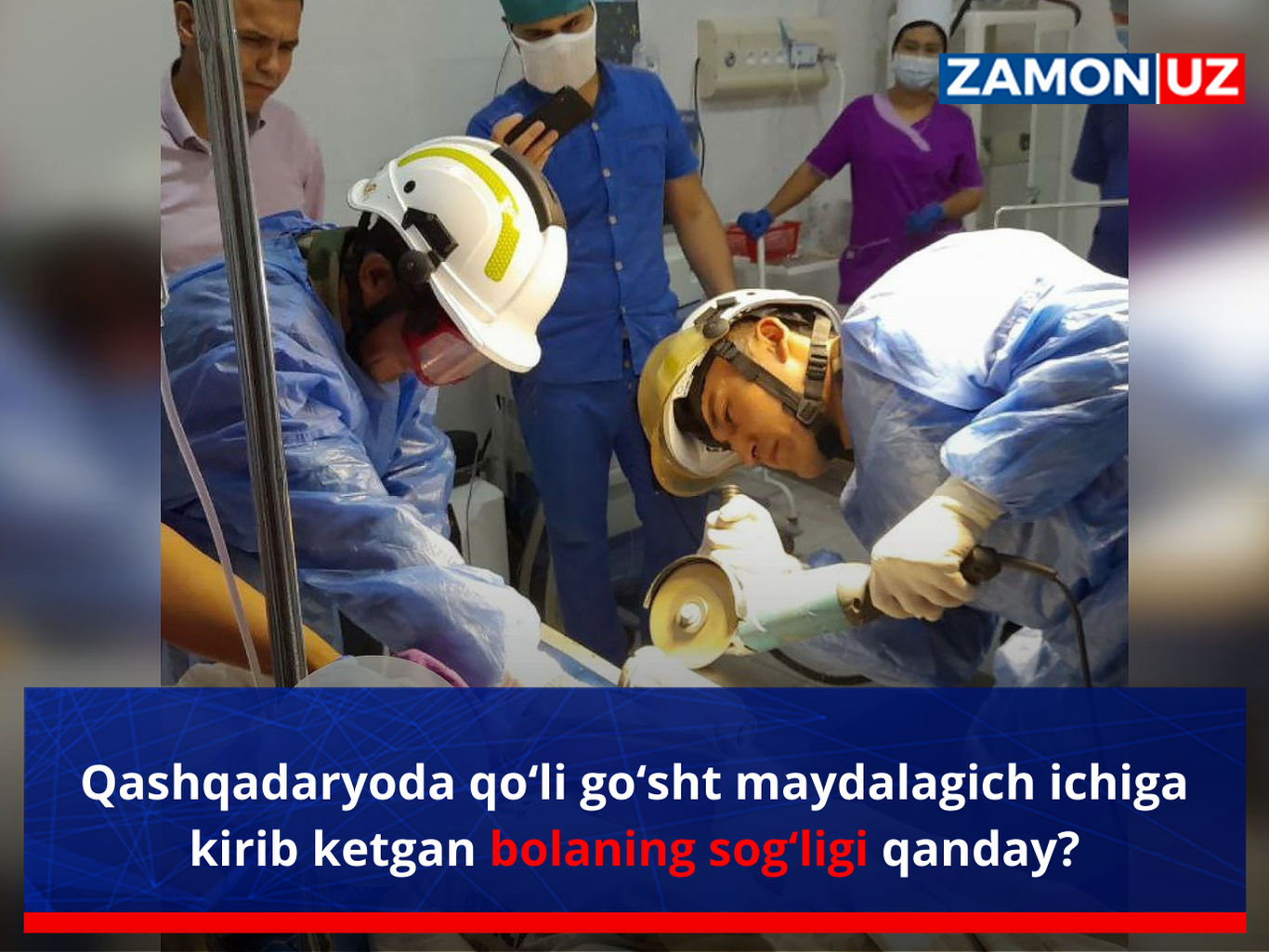 Qashqadaryoda qo‘li go‘sht maydalagich ichiga kirib ketgan bolaning sog‘ligi qanday?