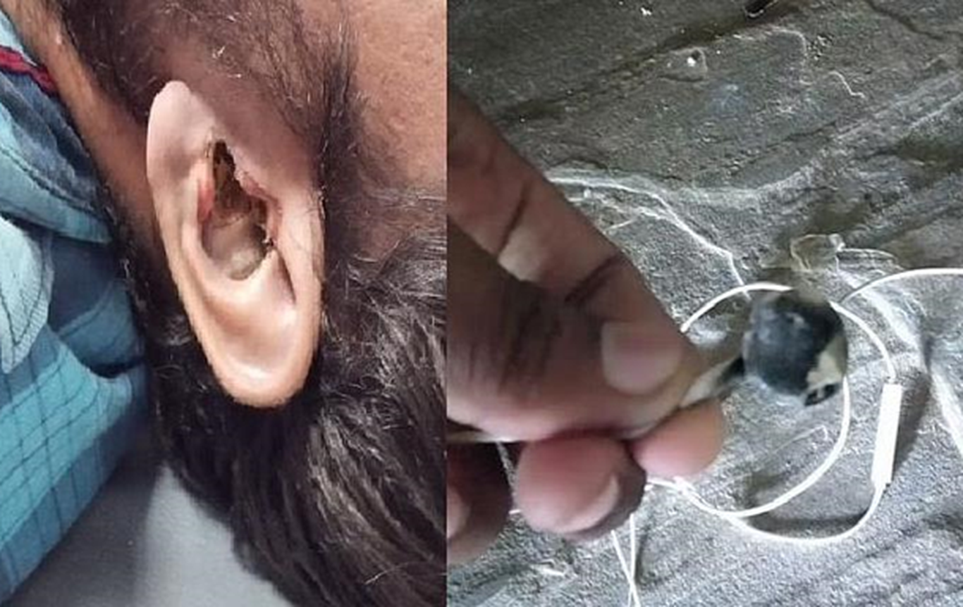 Hindistonda quloqchini portlashi oqibatida 28 yoshli erkak halok bo‘ldi