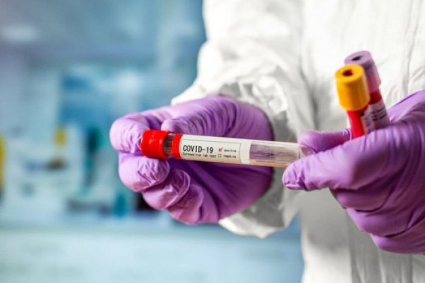 Koronavirus va pnevmoniyaga chalingalar soni keskin oshmoqda