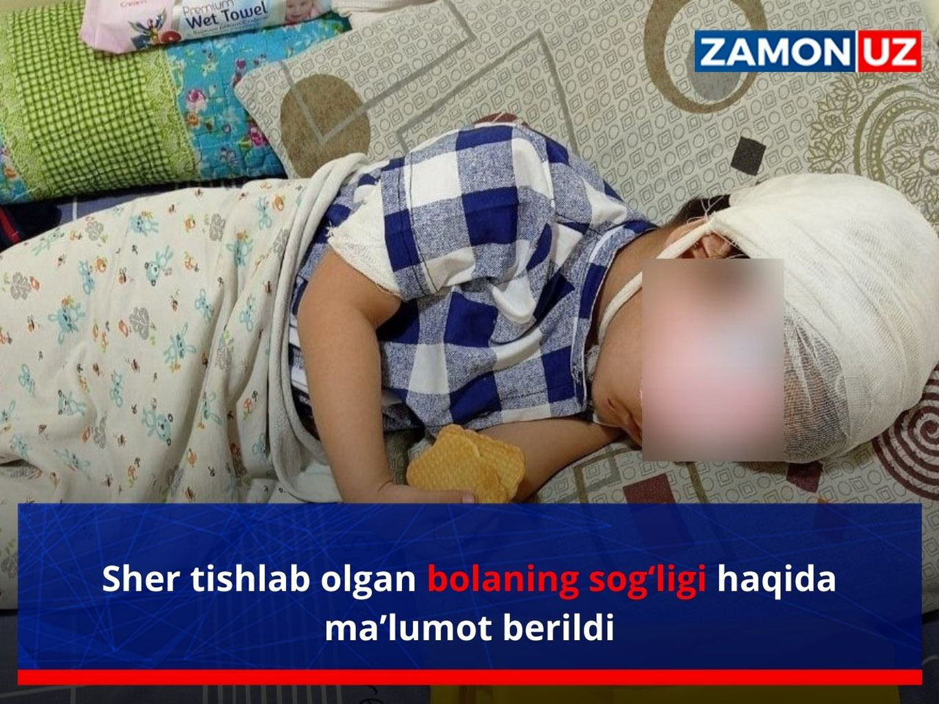 Sher tishlab olgan bolaning sog‘ligi haqida ma’lumot berildi