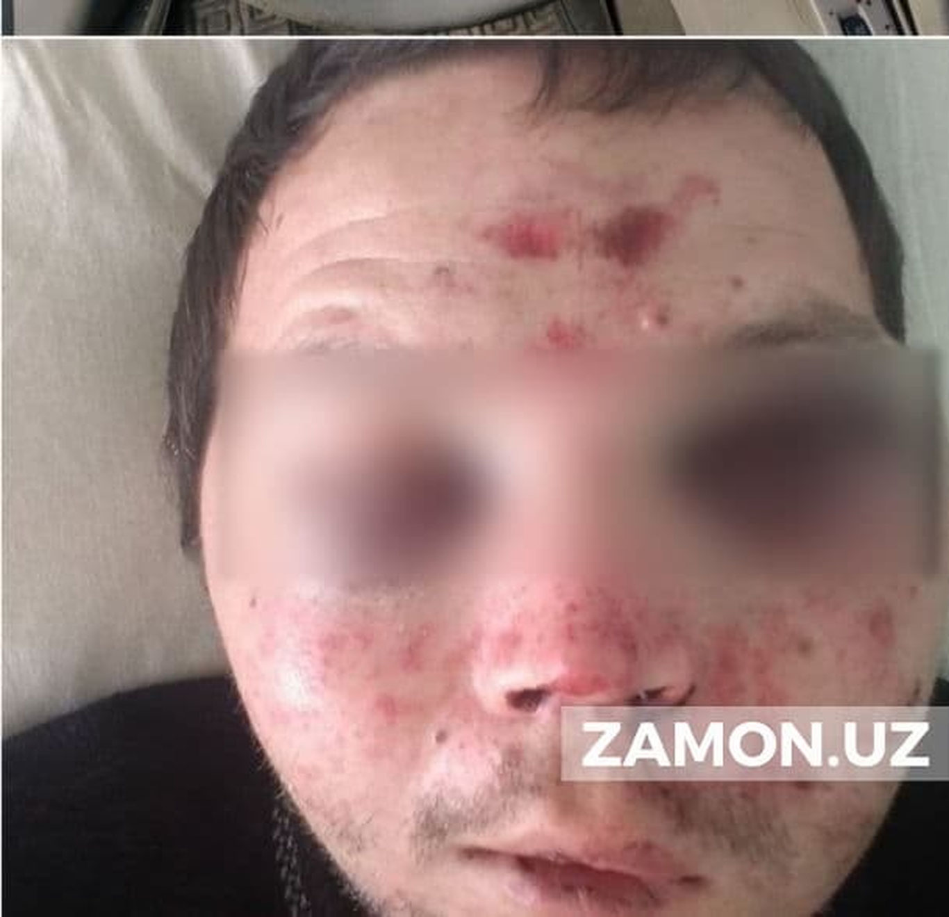 Yo'lovchilardan niqob taqishni so‘ragan haydovchi kaltaklandi