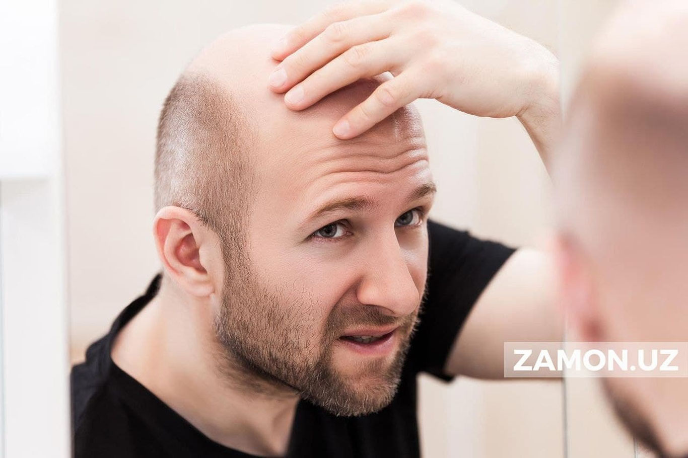 Олимлар соч тўкилиши сабабини аниқладилар