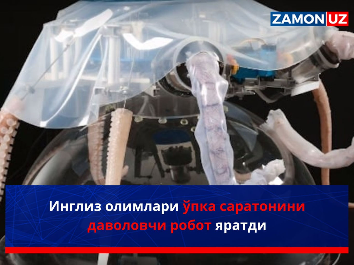Инглиз олимлари ўпка саратонини даволовчи робот яратди