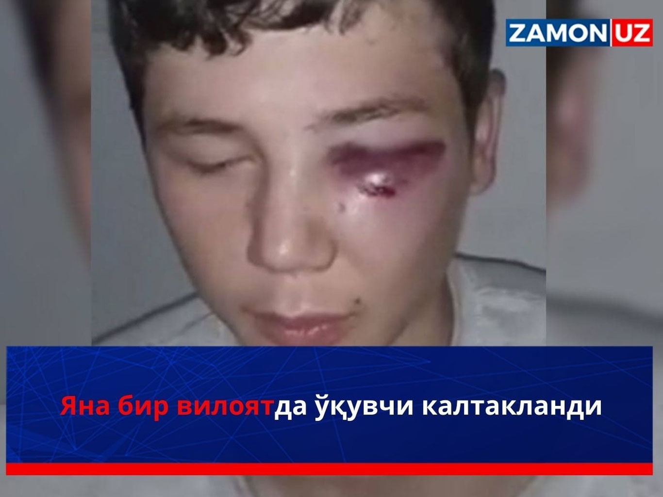 Яна бир вилоятда ўқувчи калтакланди