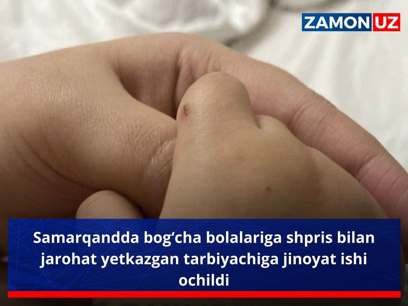 Samarqandda bog‘cha bolalariga shpris bilan jarohat yetkazgan tarbiyachiga jinoyat ishi ochildi