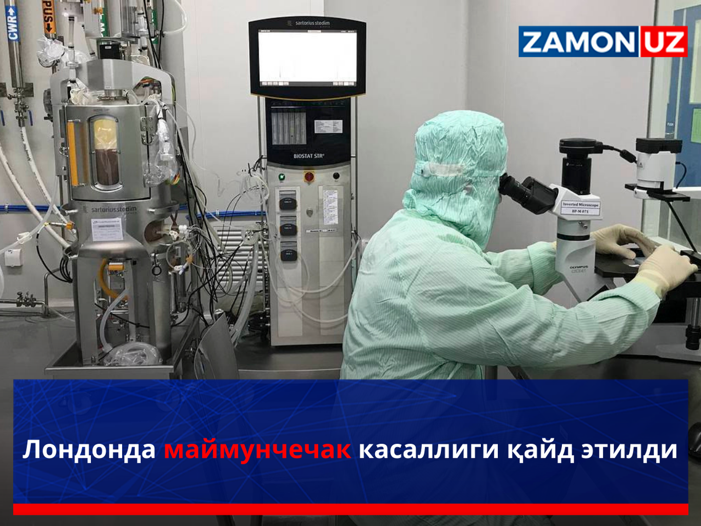 Лондонда маймунчечак касаллиги қайд этилди