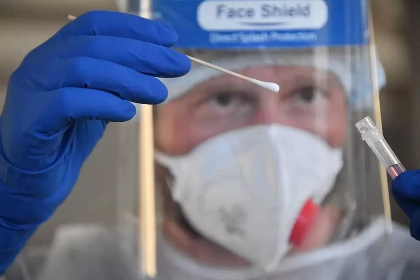 Koronavirus laboratoriyada sunʼiy yaratilgan bo‘lishi mumkin