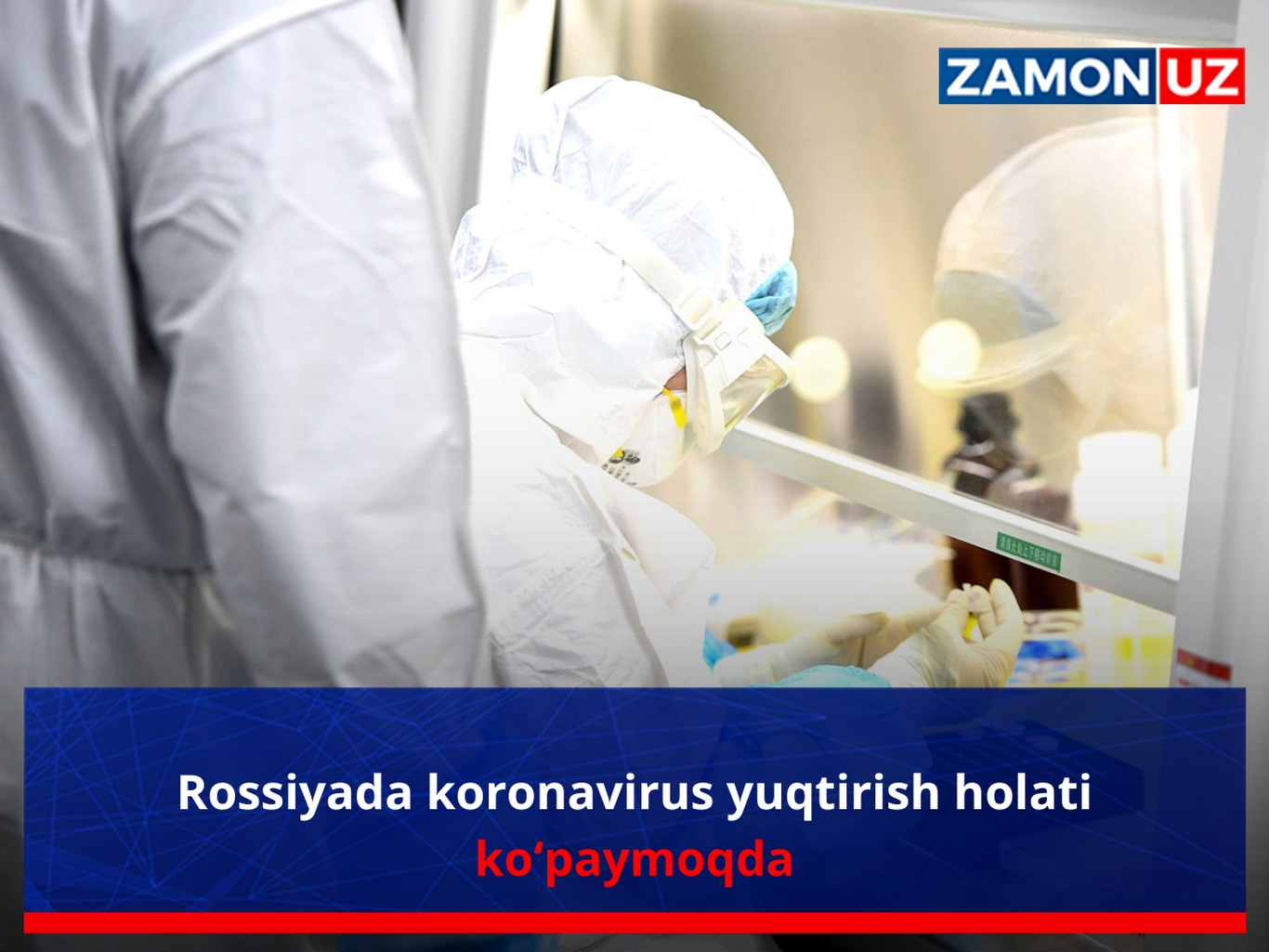 Rossiyada koronavirus yuqtirish holati ko‘paymoqda