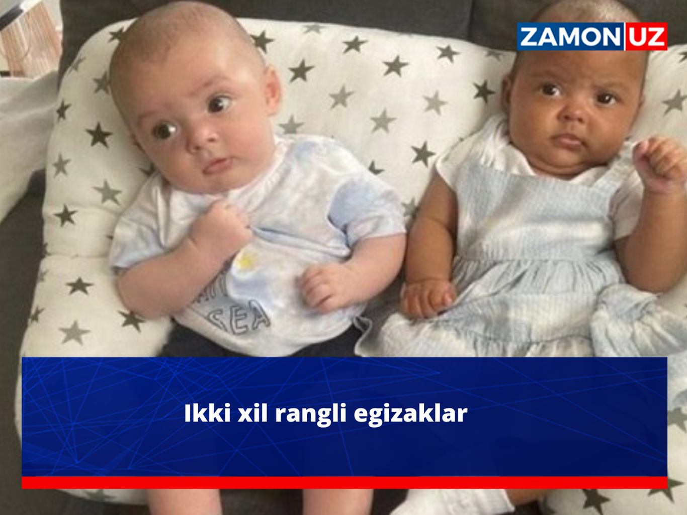 Икки хил рангли эгизаклар