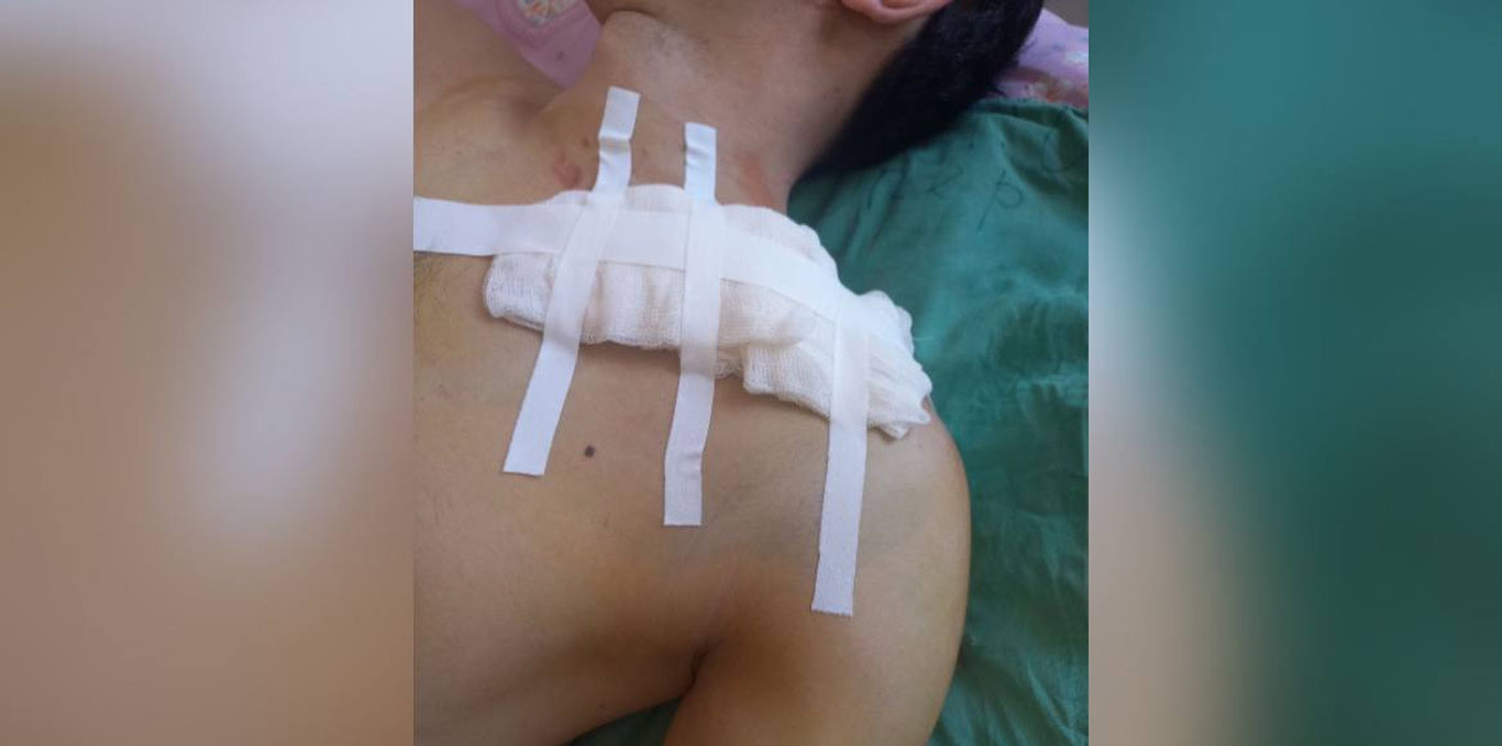 To‘rtko‘lda Malibu haydovchisi nogiron fuqaroni kaltakladi