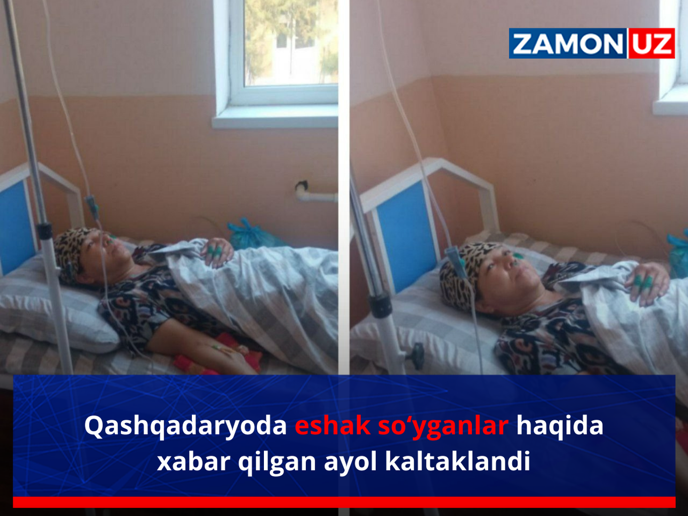 Қашқадарёда эшак сўйганлар ҳақида хабар қилган аёл калтакланди