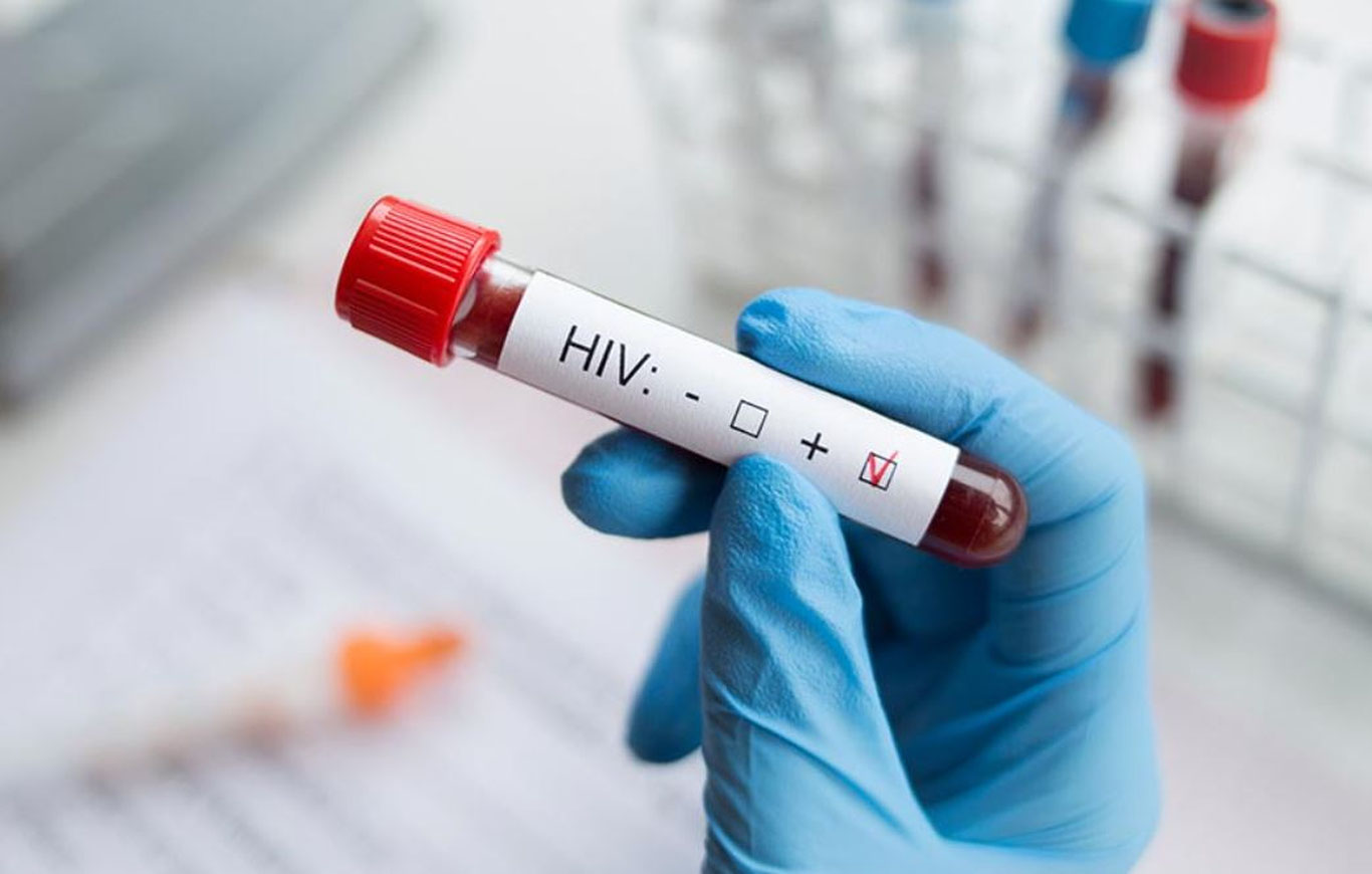 Ўзбекистонда қанча одамда ОИВ касаллиги борлиги айтилди