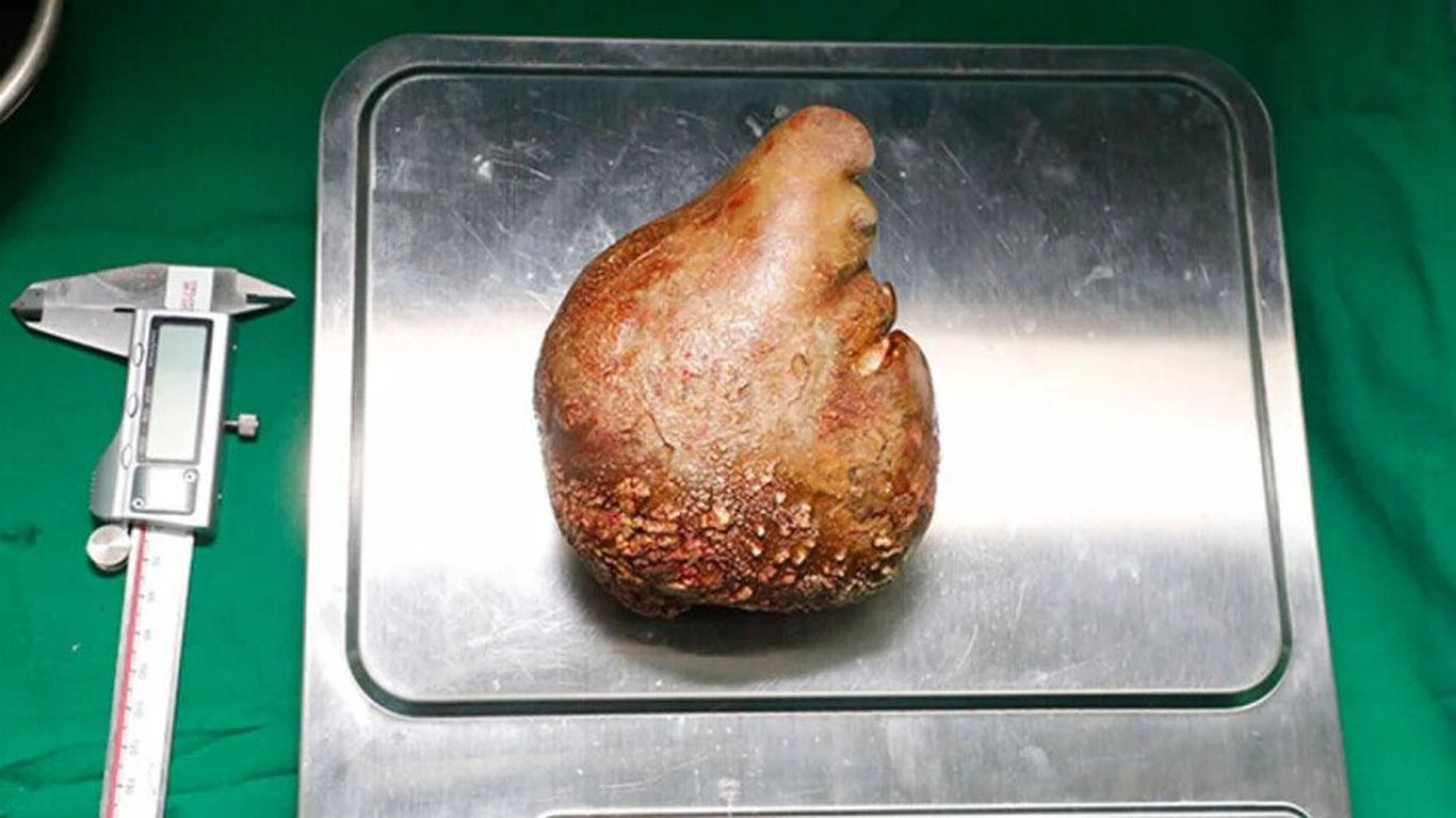 Шри-Ланкада ноодатий рекорд қайд этилди