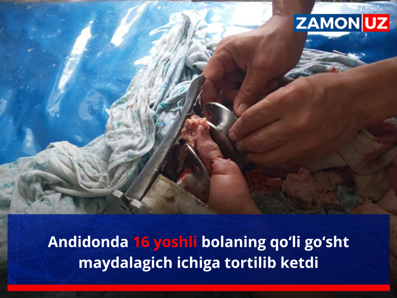 Andijonda 16 yoshli bolaning qo‘li go‘sht maydalagich ichiga tortilib ketdi