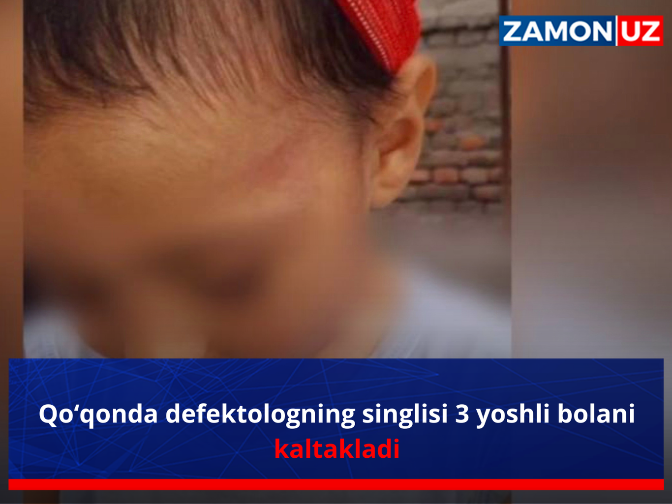 Қўқонда дефектологнинг синглиси 3 ёшли болани калтаклади