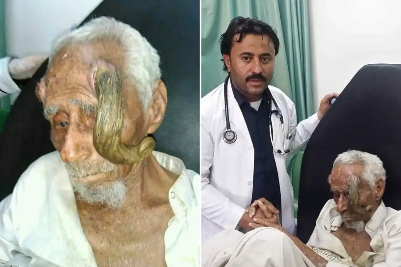 Дунёнинг "икки шохли" одами вафот этди