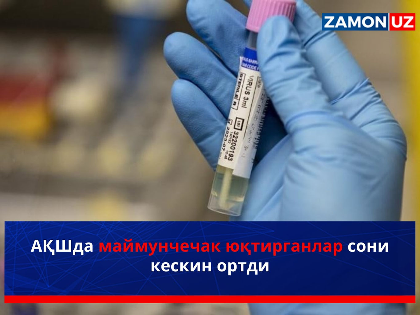 АҚШда маймунчечак юқтирганлар сони кескин ортди