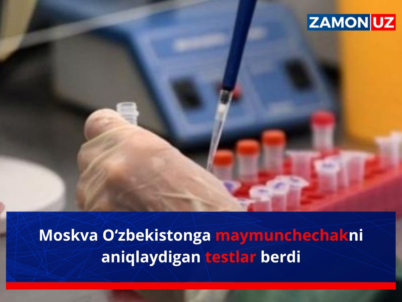 Москва Ўзбекистонга маймунчечакни аниқлайдиган тестлар берди
