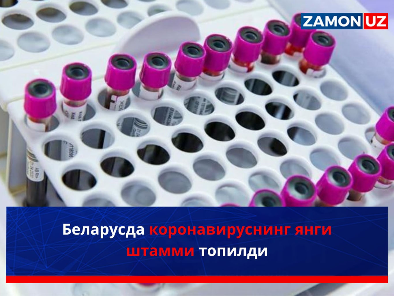 Беларусда коронавируснинг янги штамми топилди