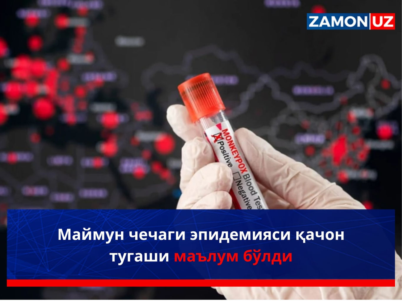 Маймунчечак эпидемияси қачон тугаши маълум бўлди