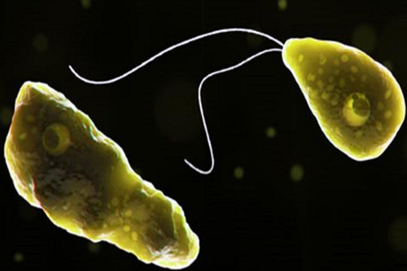 Pokistonlik erkak "miyani yeyuvchi" infeksiya tufayli vafot etdi