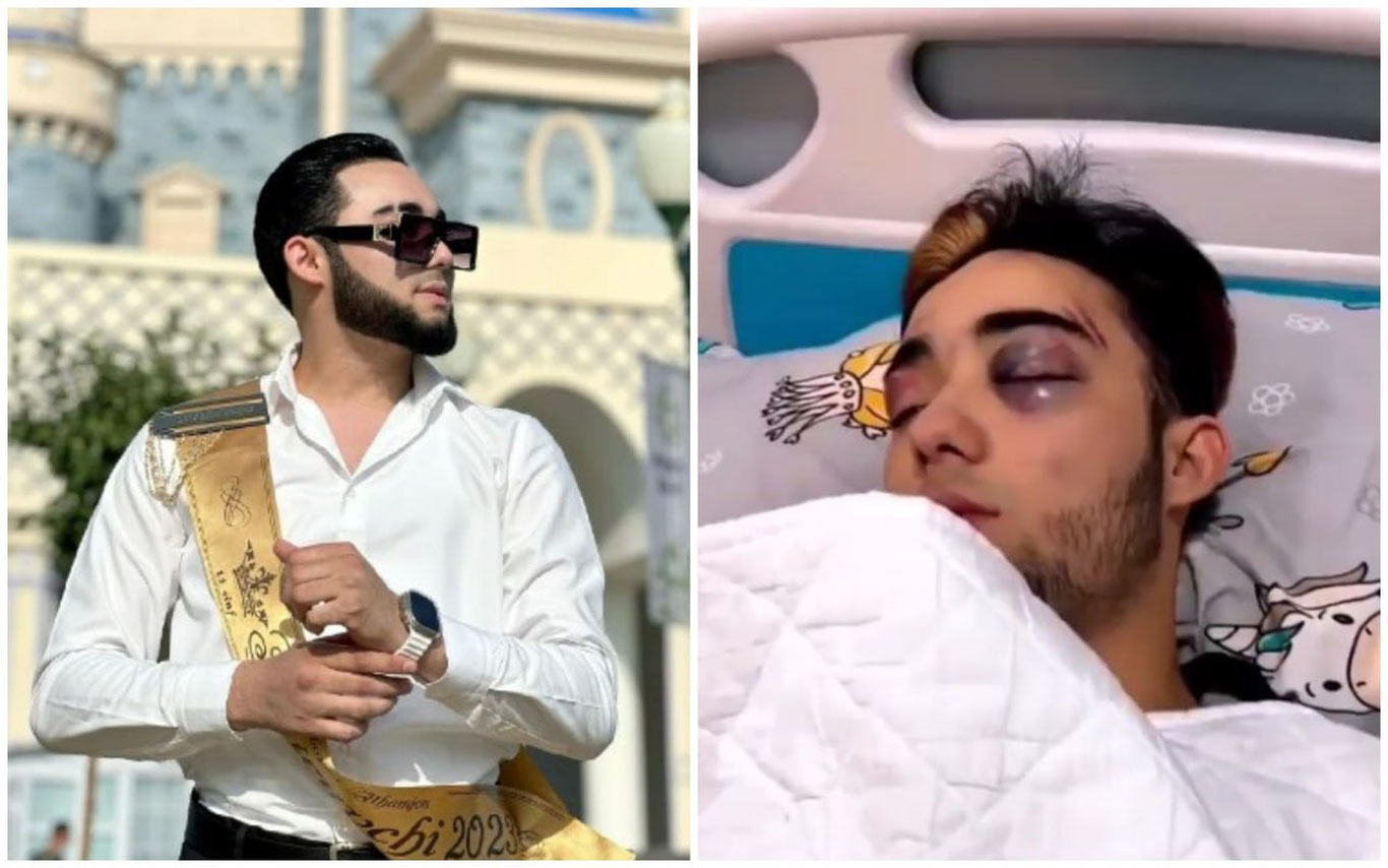 20 ёшли блогер операция вақтида вафот этди