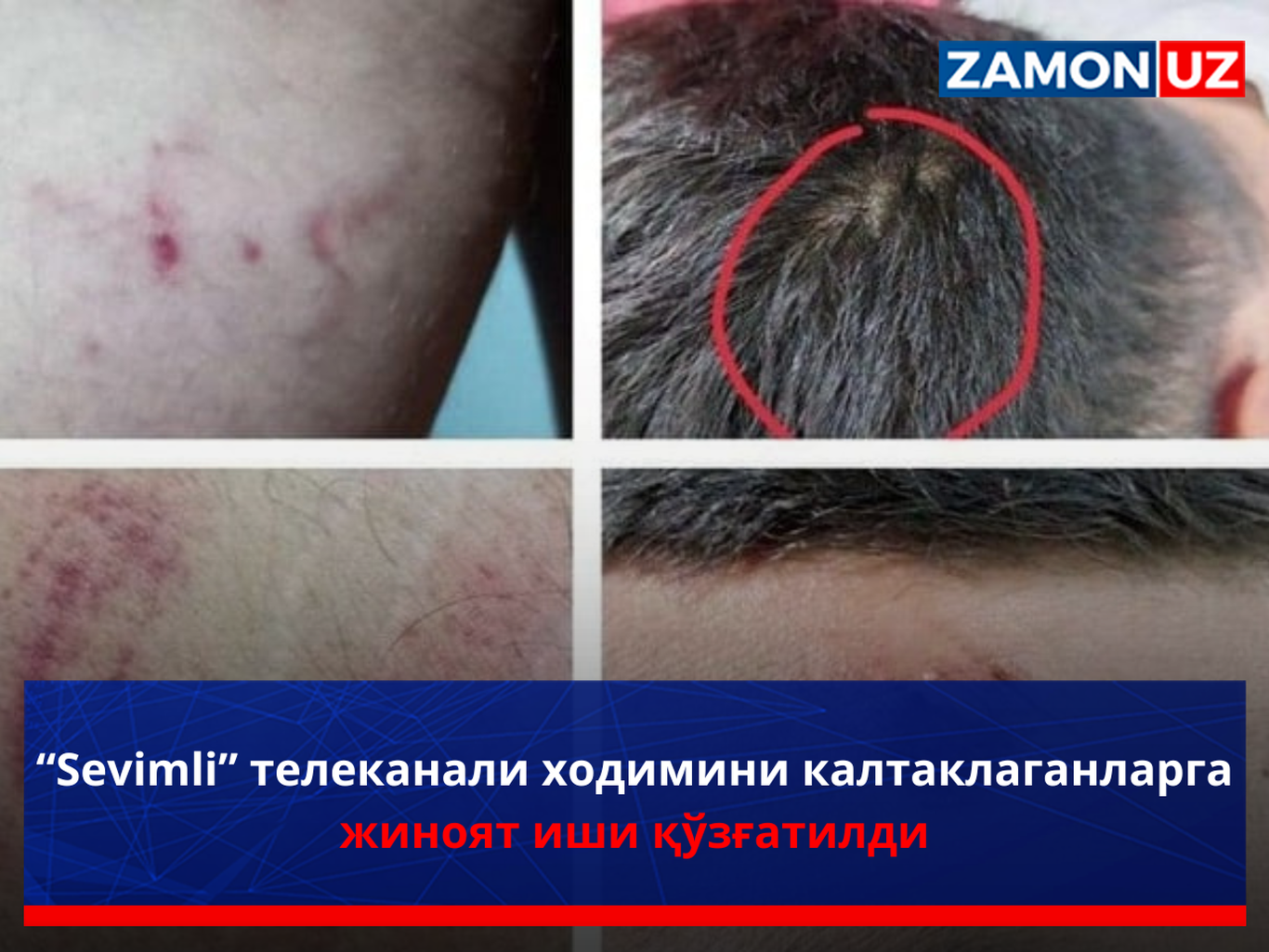 “Sevimli” телеканали ходимини калтаклаганларга жиноят иши қўзғатилди