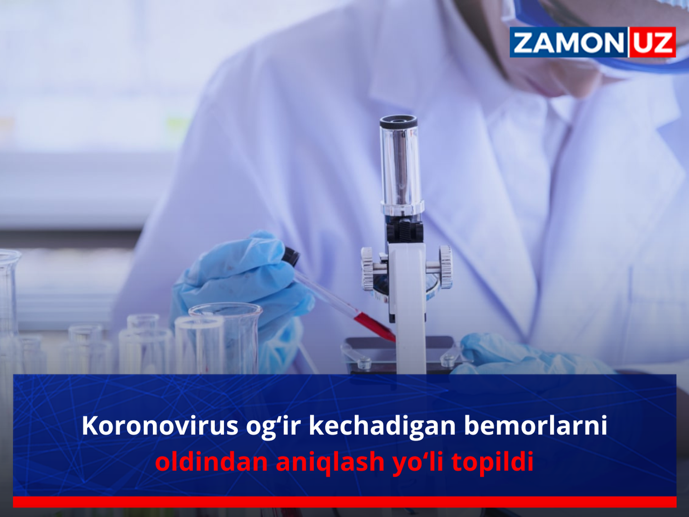 Koronovirus og‘ir kechadigan bemorlarni oldindan aniqlash yo‘li topildi