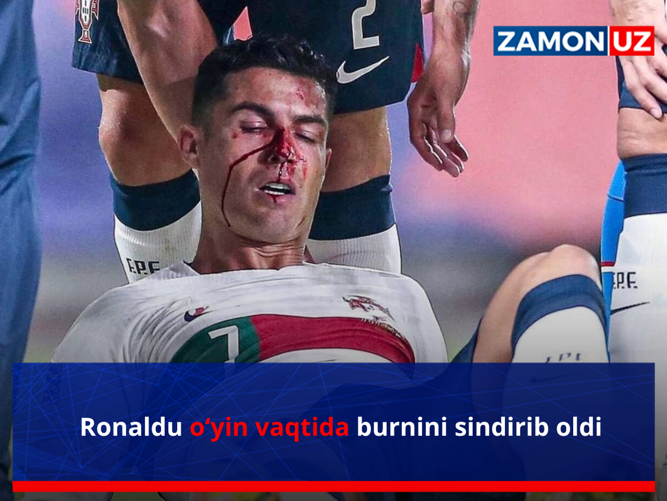Роналду ўйин вақтида бурнини синдириб олди