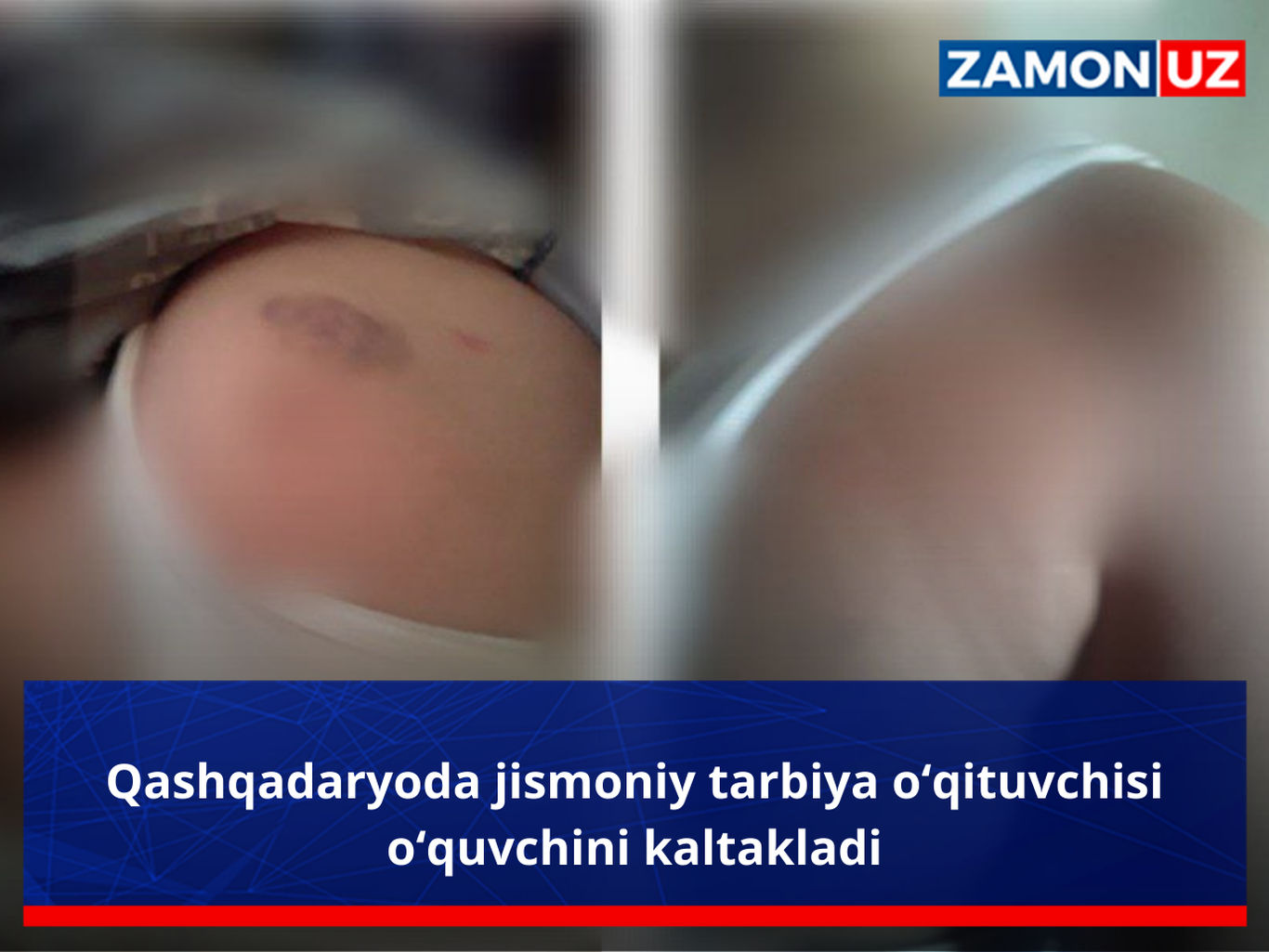 Қашқадарёда жисмоний тарбия ўқитувчиси ўқувчини калтаклади