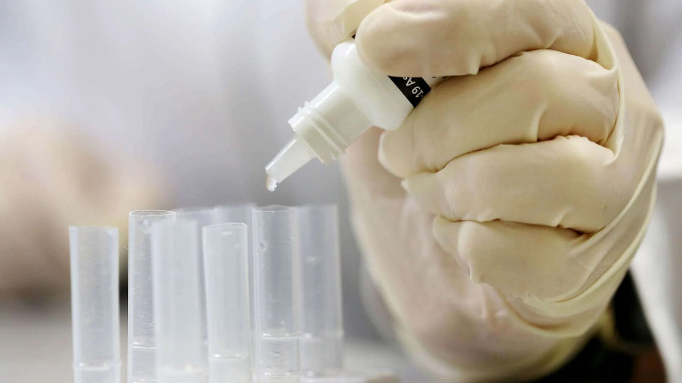 Замбияда куйдирги касаллиги авж олди