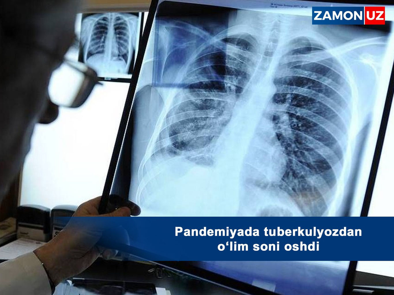 Falastin prezidentining mashinasiga hujum qilindi