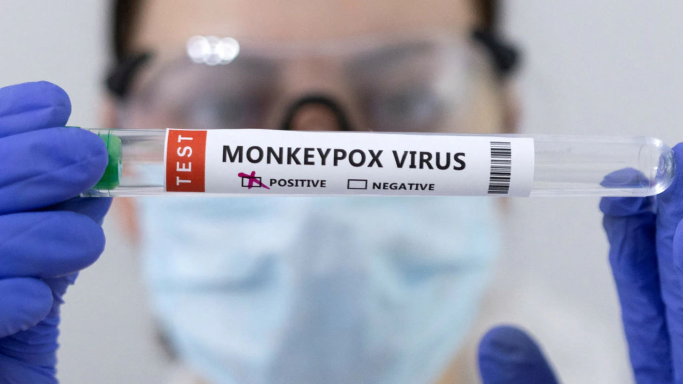 JSST maymun chechagi bilan bog‘liq epidemiologik vaziyatdan xavotirda