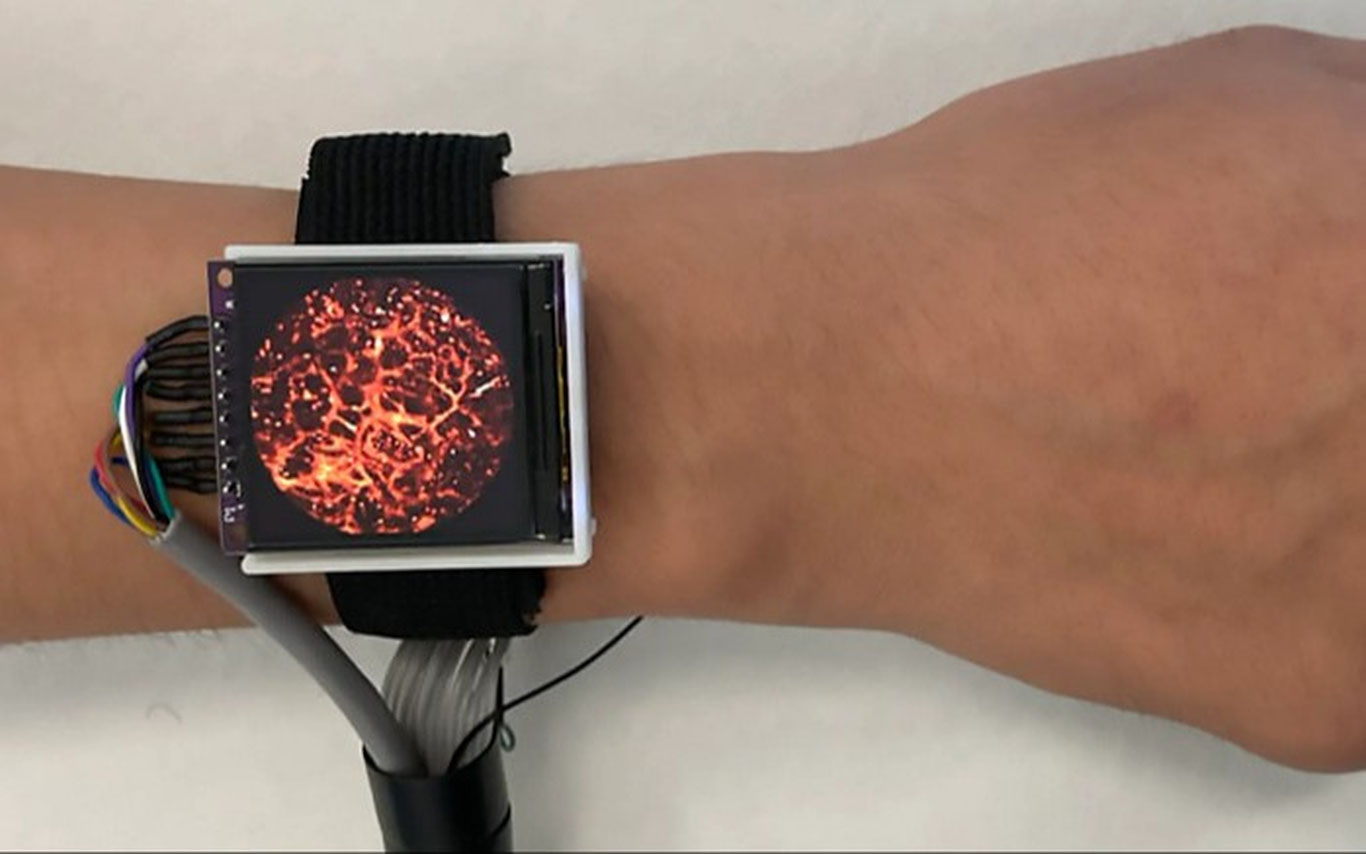 Қон томирлари ичини кўриш имконини берувчи сенсор яратилди