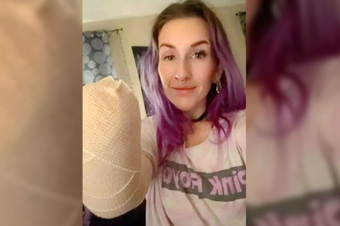 Америкалик аёл соч қуритгич сабаб бир қўлидан айрилди