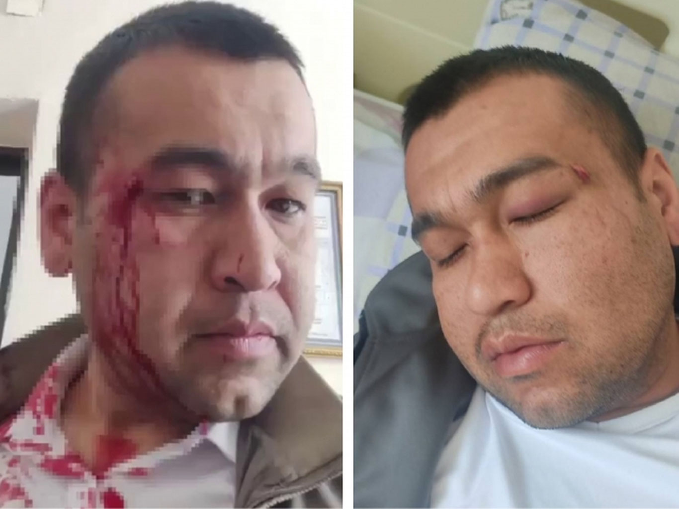 Фарғонада ўқитувчи аёвсиз калтаклаб кетилди