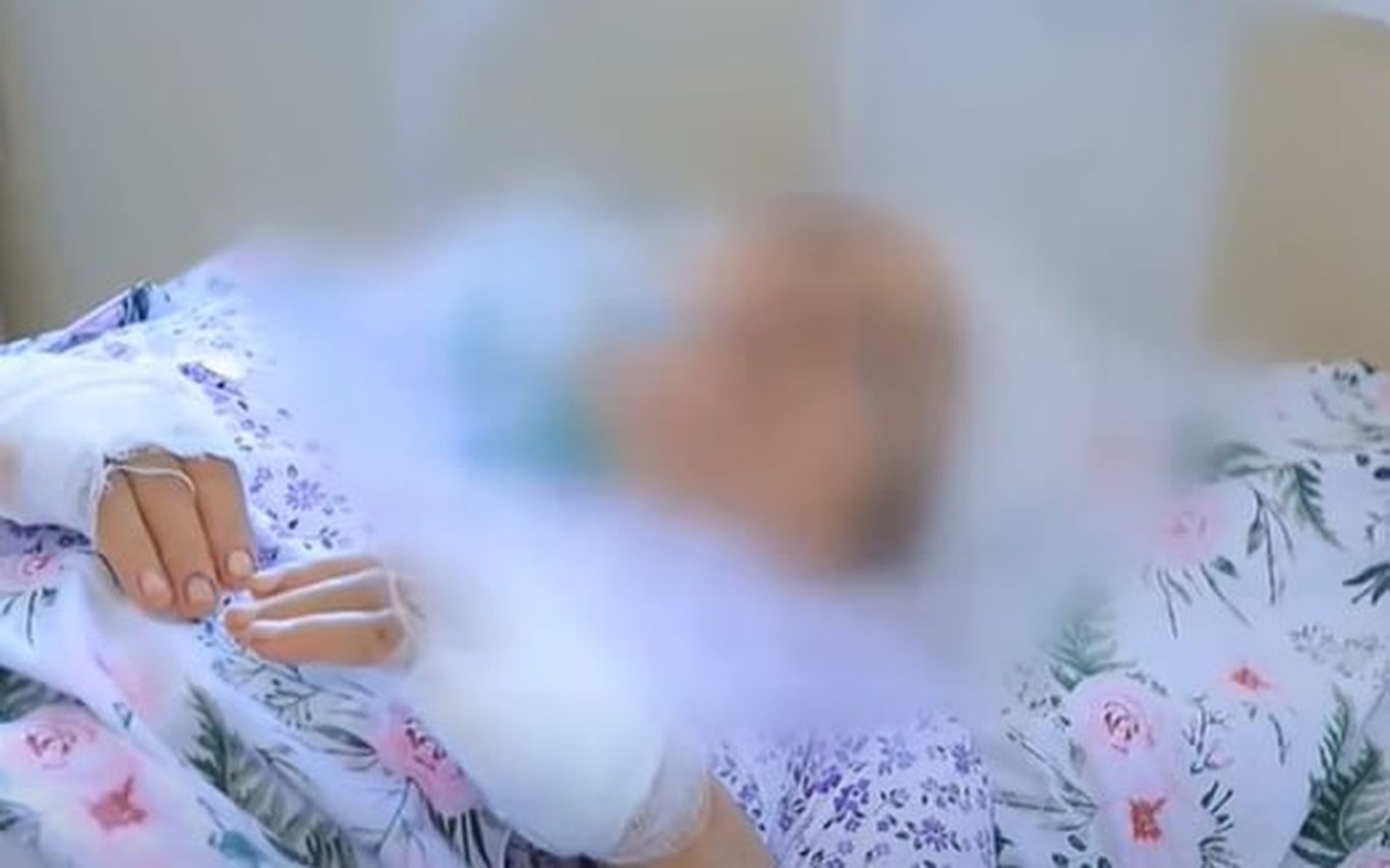 Фарғоналик йигит онасининг бармоқларини кесиб ташлади