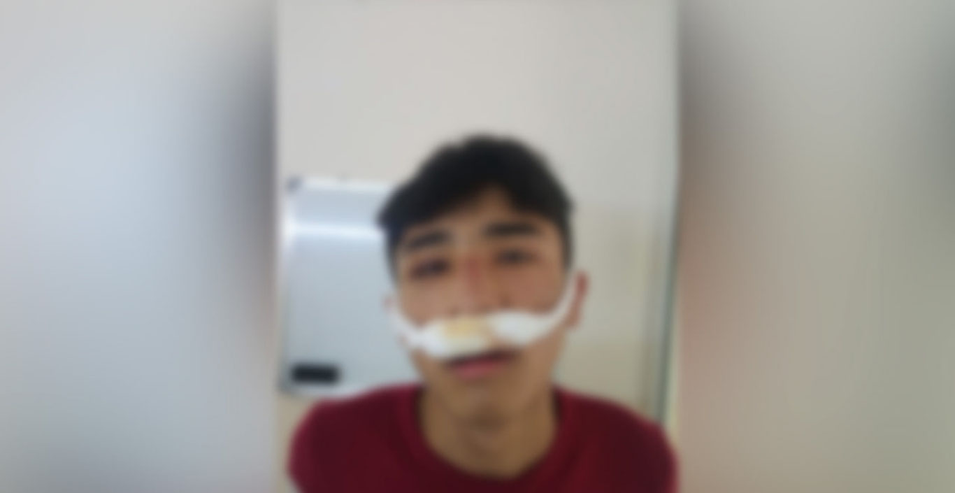 Ўрта Чирчиқда мактаб ўқувчиси дўппосланди