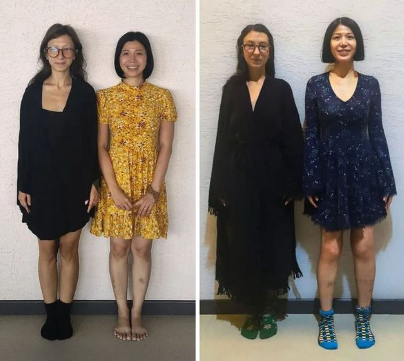 Америкалик аёл операция орқали бўйини ўстирди