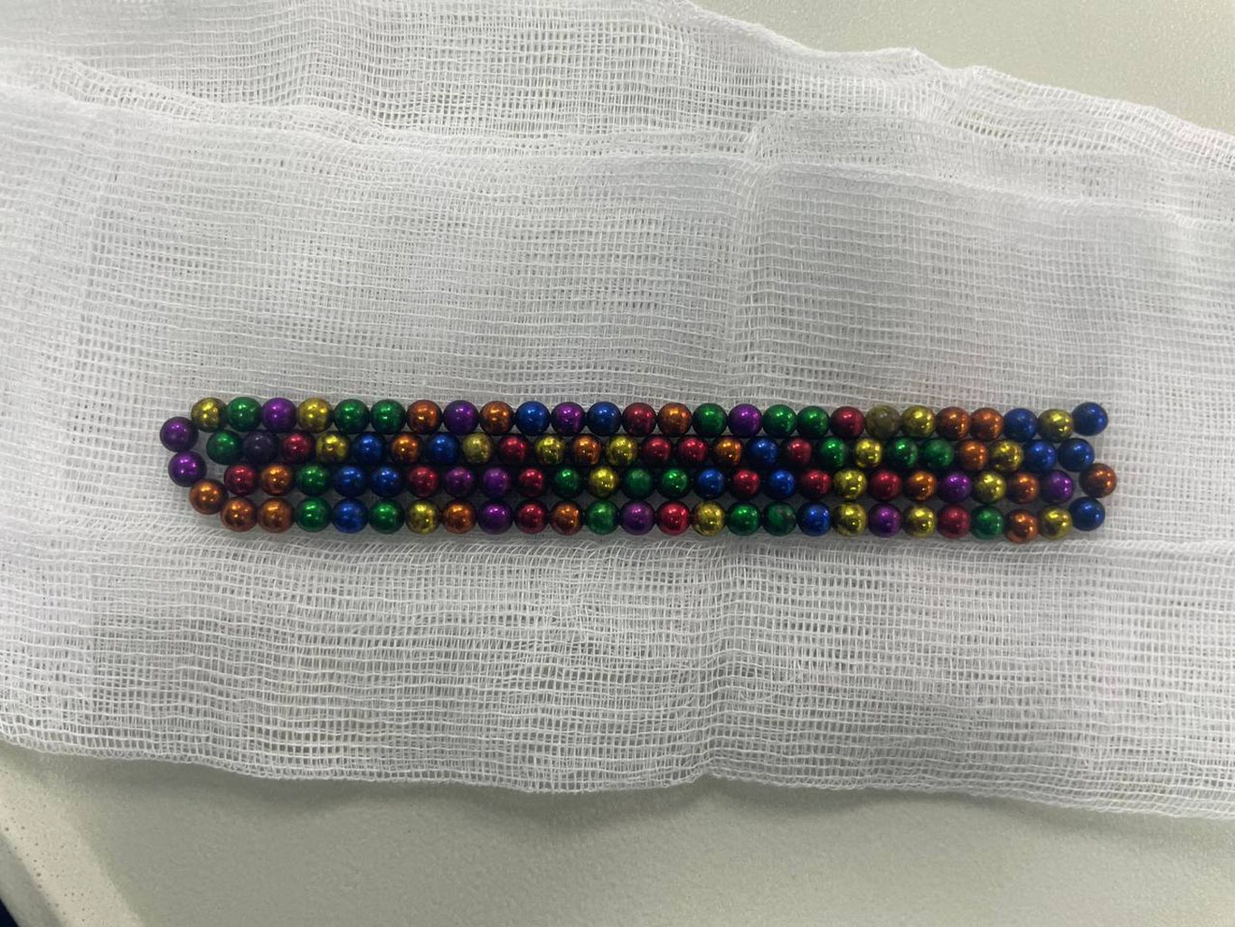 Қозоғистонда 2 ёшли бола 105 та магнит ютиб юборди