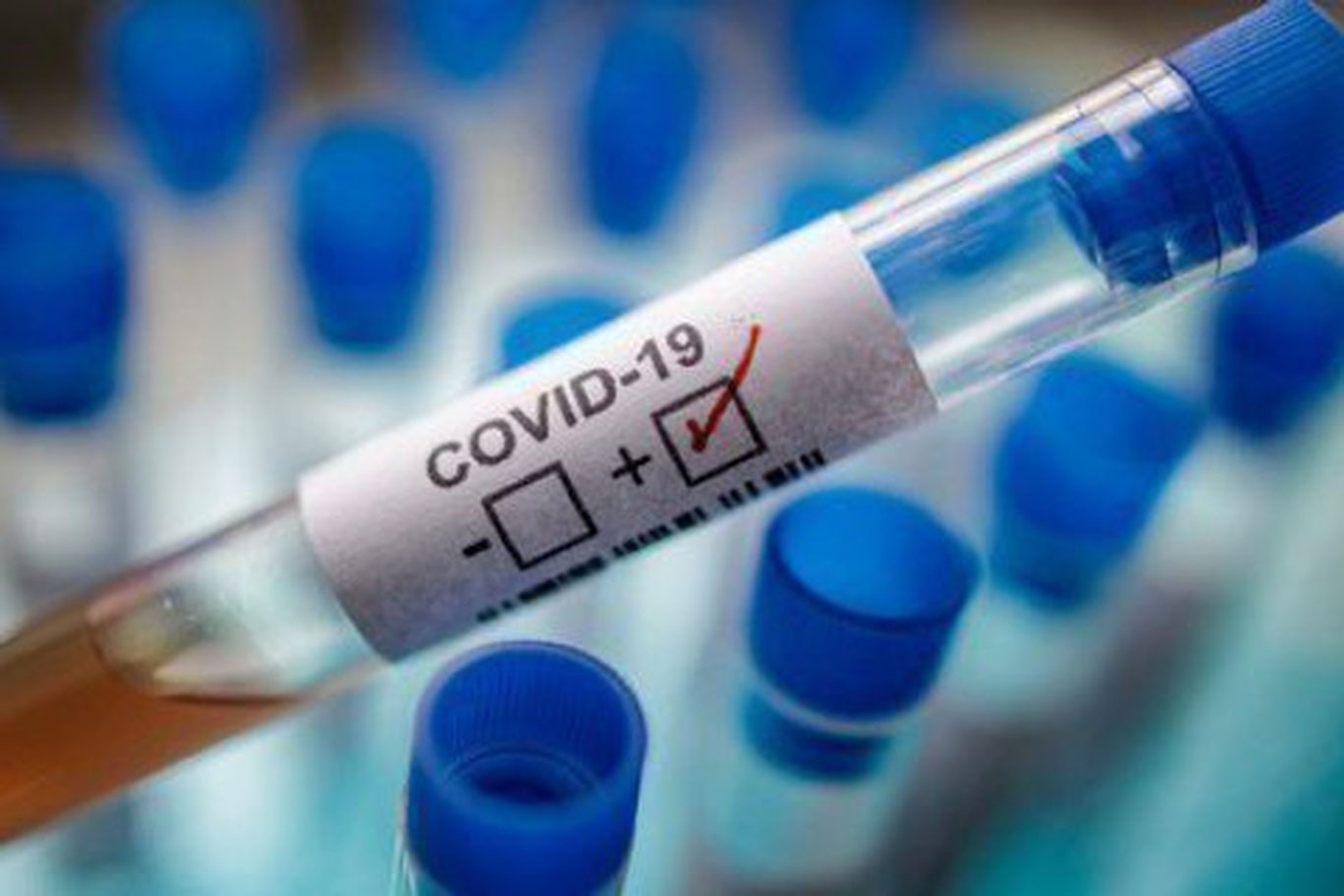 Дунё бўйлаб COVID-19 нинг янги штамми тарқалмоқда