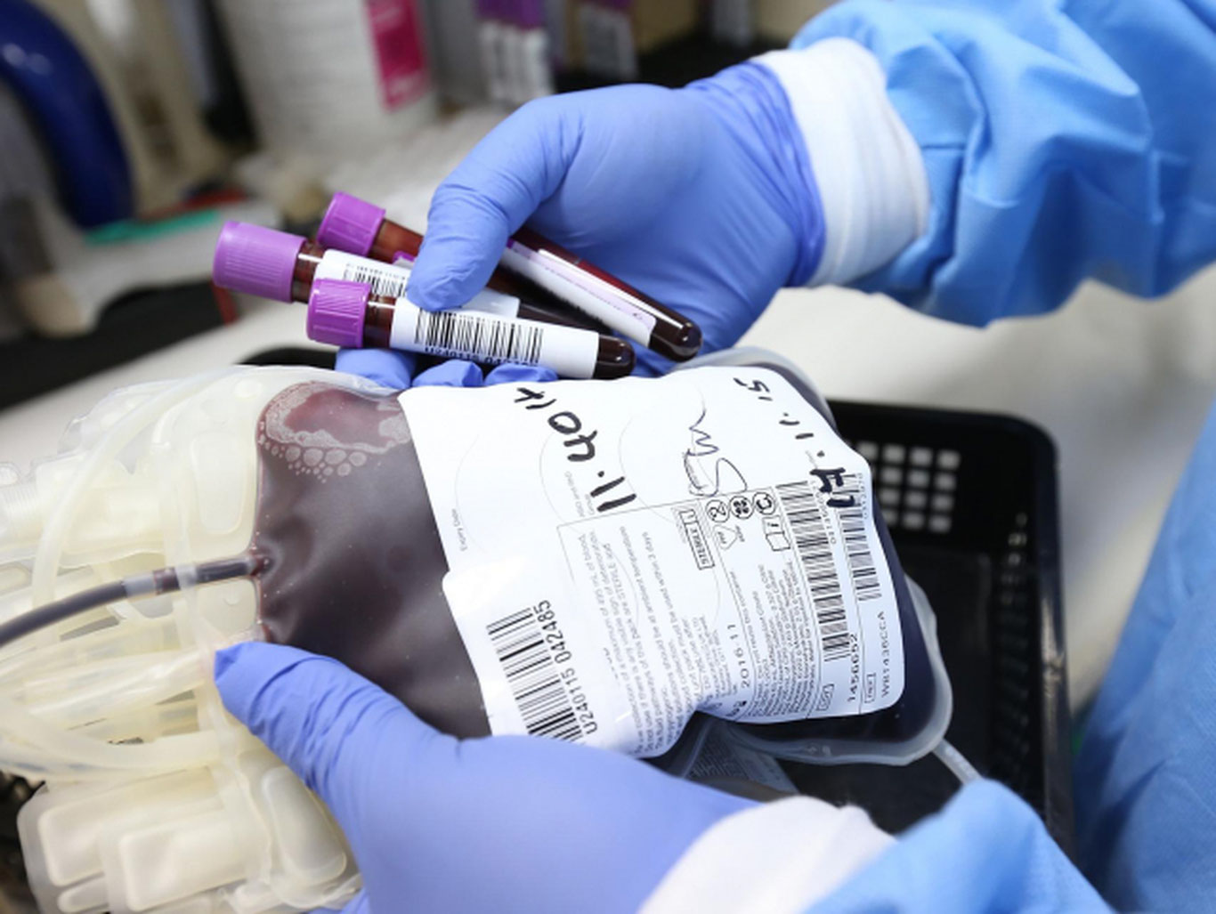 Ўзбекистонда илк бор қон плазмасидан инсон альбумини ишлаб чиқариш бошланади