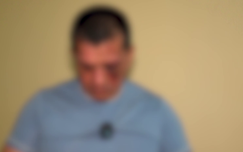 custom img