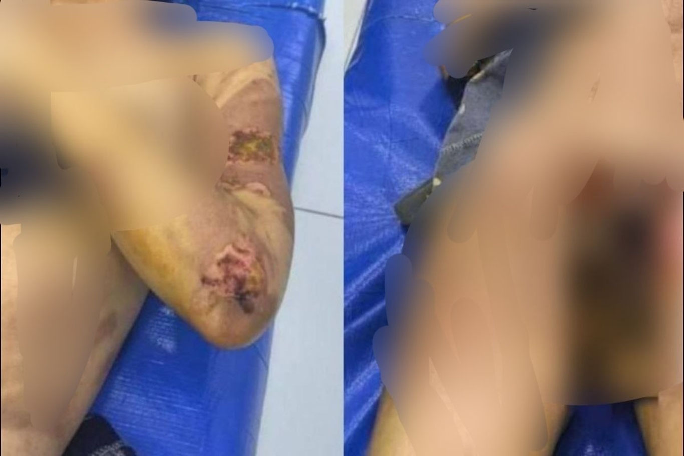 Ustingga qaynoq suv quysam, kuyasanmi? — Jizzaxdagi kelinga zo‘ravonlik holati yuzasidan jinoyat ishi qo‘zg‘atildi